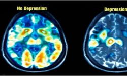 روسيا.. اكتشاف مؤشر بيولوجي على "صحة الدماغ"